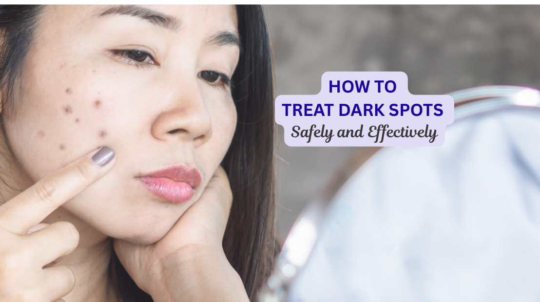 How to Treat Dark Spots Safely and Effectively
